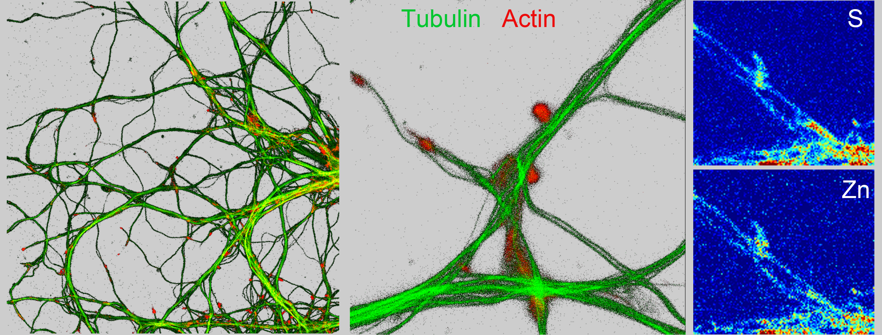 Nano-imagerie de la tubuline et de l&rsquo;actine, du soufre et du zinc, de dendrites et compartiments synaptiques de neurones de l&rsquo;hippocampe.