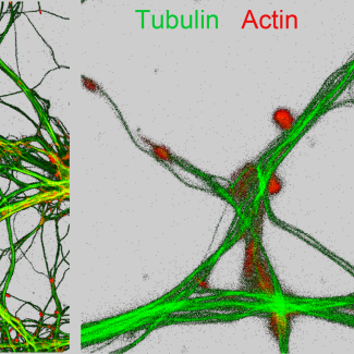 Nano-imagerie de la tubuline et de l’actine, du soufre et du zinc, de dendrites et compartiments synaptiques de neurones de l’hippocampe.